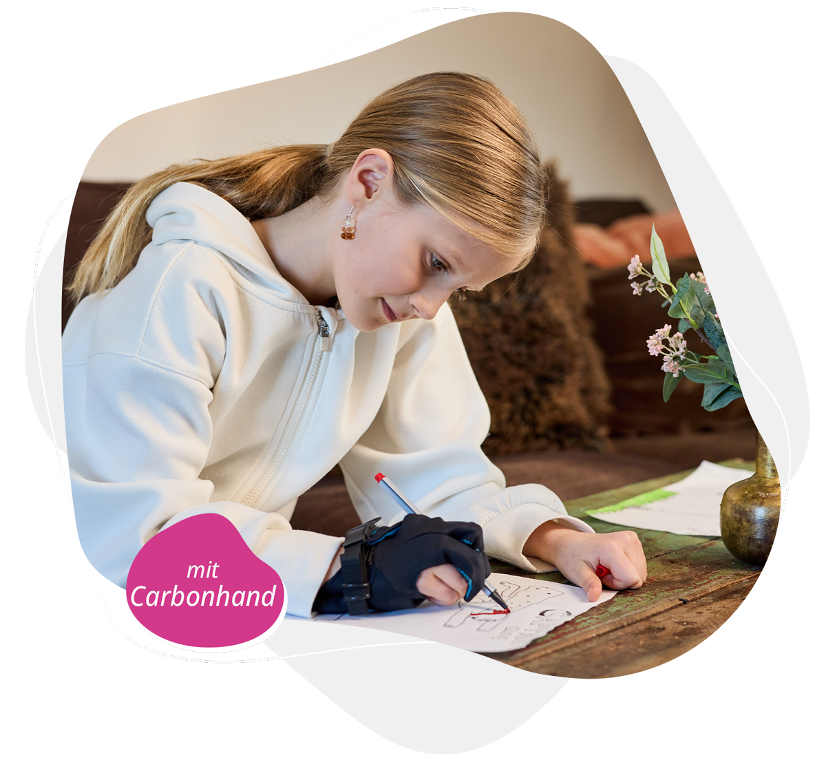 Carbonhand_Vierbaum-Neuro-Orthopaedie